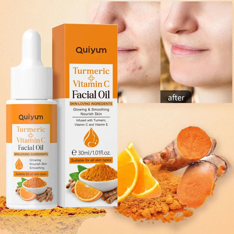 LAIKOU Turmeric & Vitamin C Face Serum – Brightening, Dark Spot Corrector, Anti-Aging & Antioxidant Facial Oil ✅FREE UK Delivery