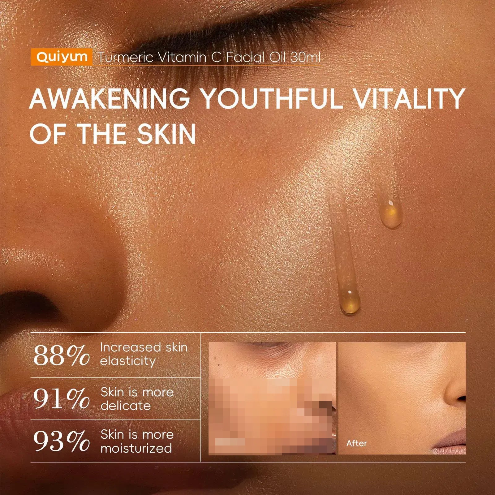 LAIKOU Turmeric & Vitamin C Face Serum – Brightening, Dark Spot Corrector, Anti-Aging & Antioxidant Facial Oil ✅FREE UK Delivery